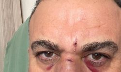 Sosyolog Özkan Yıldız bıçaklı saldırıya uğradı... "Hayatta olmam mucize"