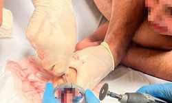 Bursa’da çocuğun parmağı çeşme aynasına sıkıştı