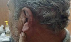 Doktor ile emekli öğretmenin mesai kavgası karakolda bitti