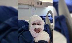 Kadıköy'de şoke eden şiddet: Kadını yaktı