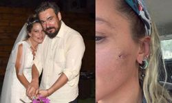 Yıldız Asyalı'nın eşi Demirci'den 'darp' iddiasına yanıt