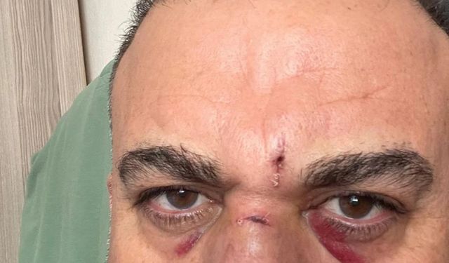 Sosyolog Özkan Yıldız bıçaklı saldırıya uğradı... "Hayatta olmam mucize"