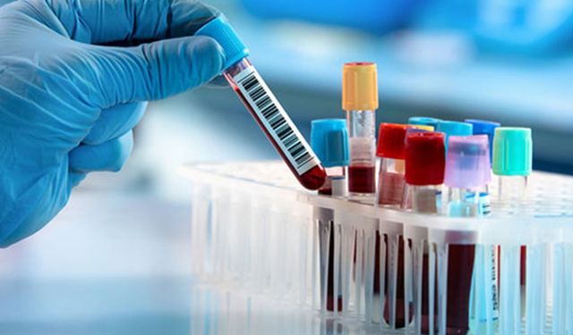 İngiltere'nin sağlık altyapısı Türk firmaya emanet