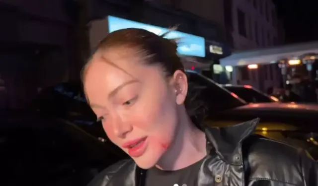 Danla Biliç'i darbeden eski sevgiliye 5 ay hapis cezası