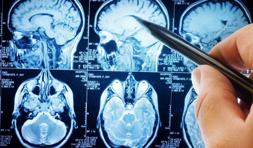 Yapay zekâ destekli kalem, Parkinson'u yüzde 95 başarıyla tespit etti