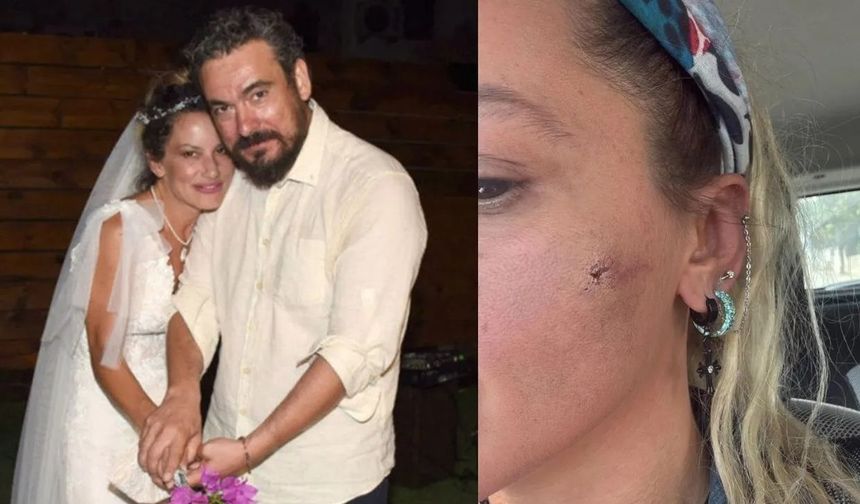 Yıldız Asyalı'nın eşi Demirci'den 'darp' iddiasına yanıt