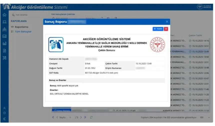 Tüberküloz takibinde dijital dönem
